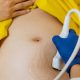 Everything You Need to Know About Getting an Ultrasound in Wayne, NJ
